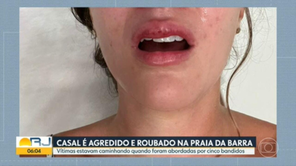 Casal é agredido e roubado por grupo de 5 bandidos na Praia da Barra