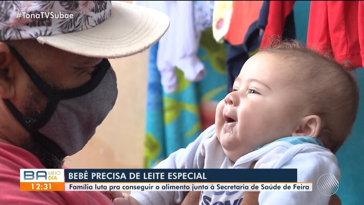 Bebê alergia a leite e fórmulas precisa de alimento especial na BA