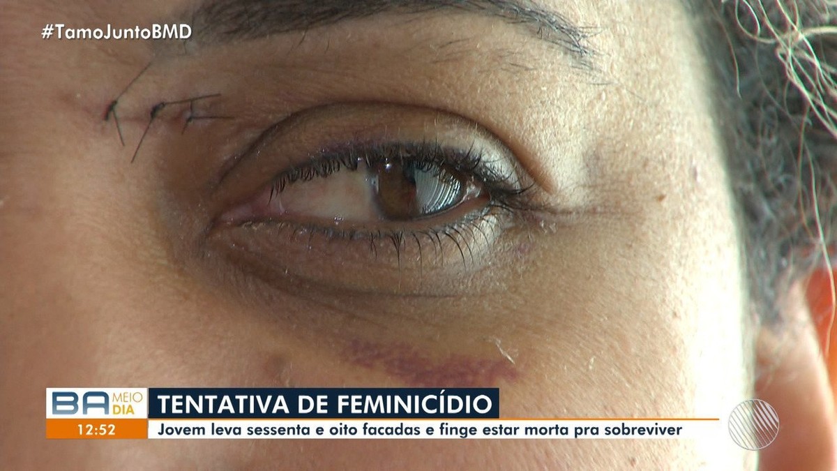 Diversos Pontos Pelo Corpo Mulher Relembra Atentado A Mando Do