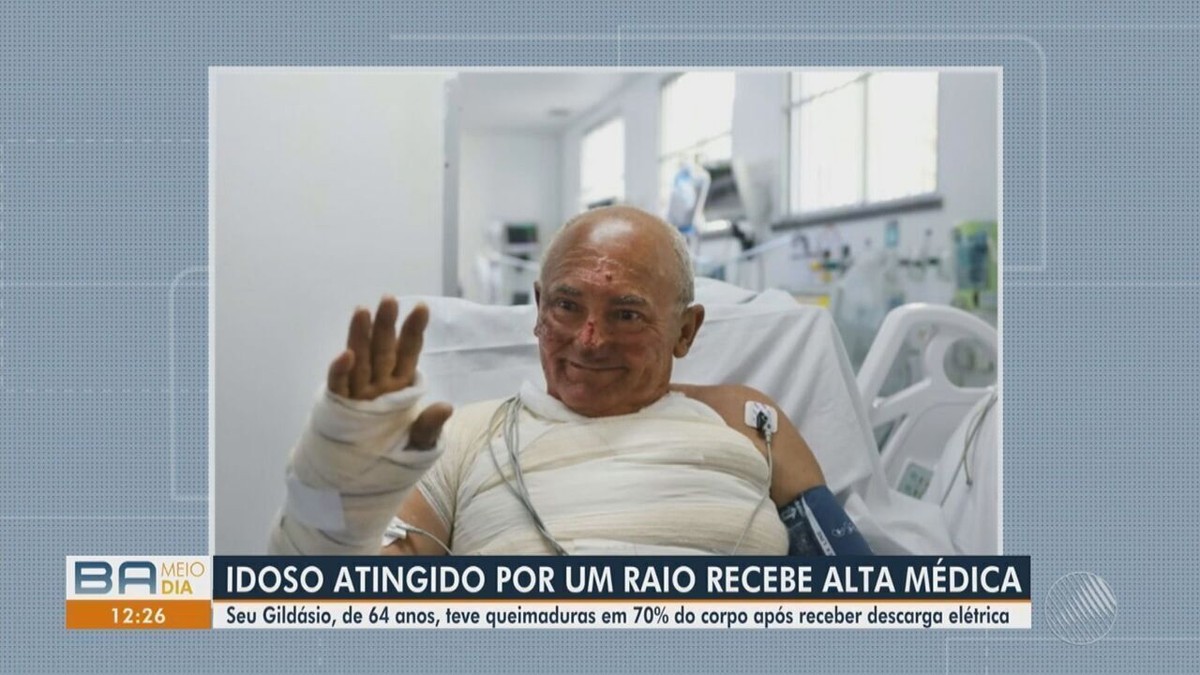 Idoso Atingido Por Raio Na Varanda De Casa Recebe Alta Hospitalar Em