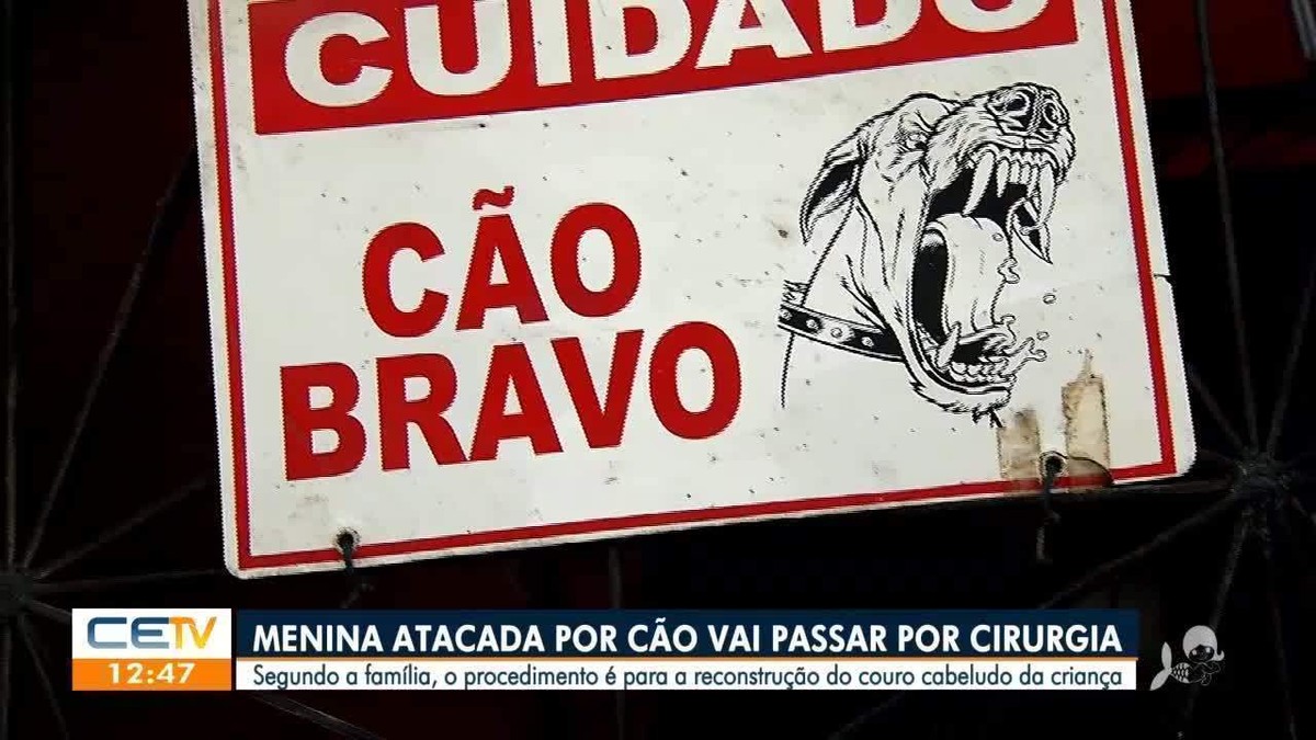 Menina Atacada Por Pitbull Em Fortaleza Apresenta Melhora E J Se