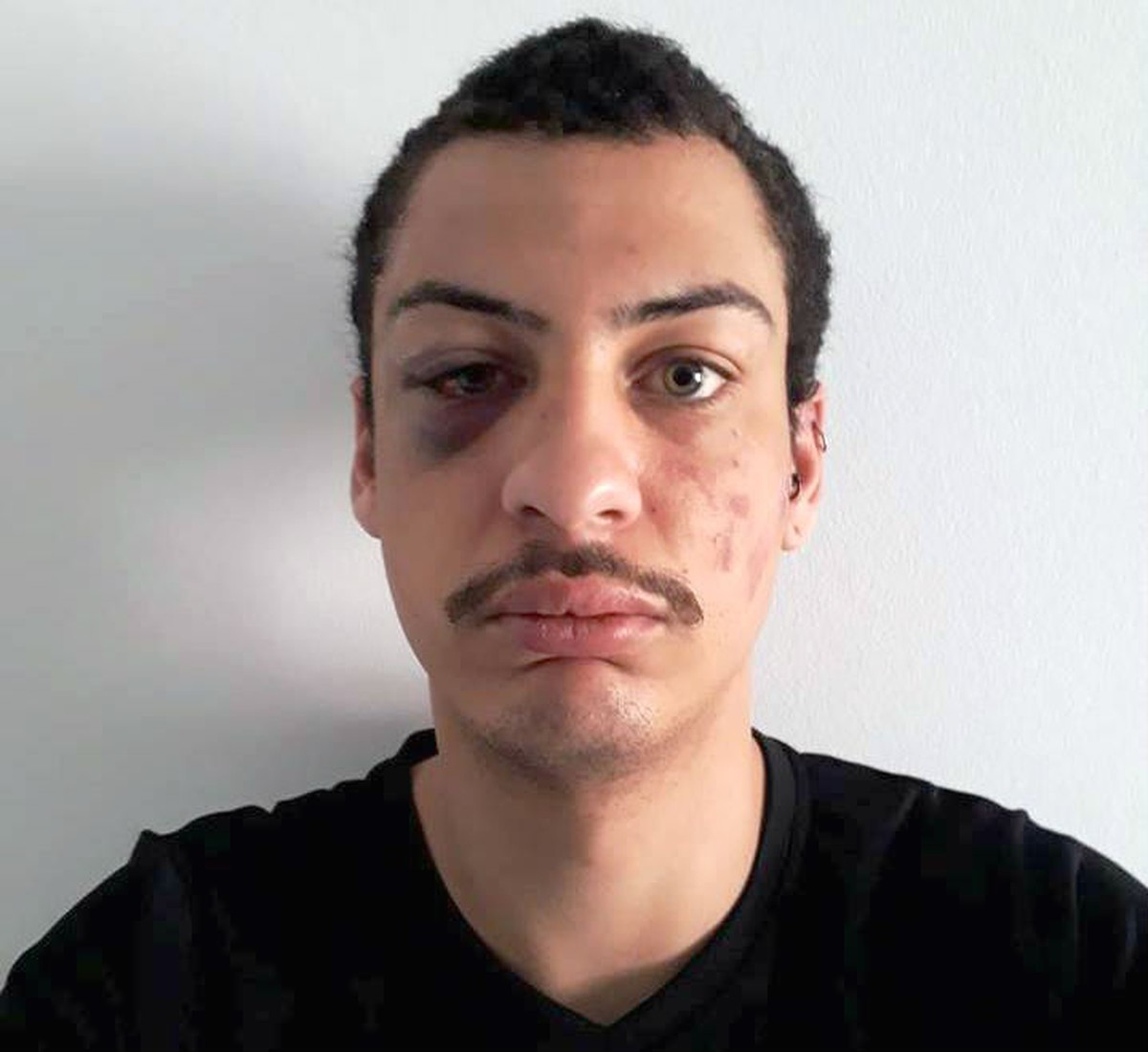 Turista Gay Espancado Por Grupo Em Sp E Post Viraliza N O Foi Minha Escolha Santos E