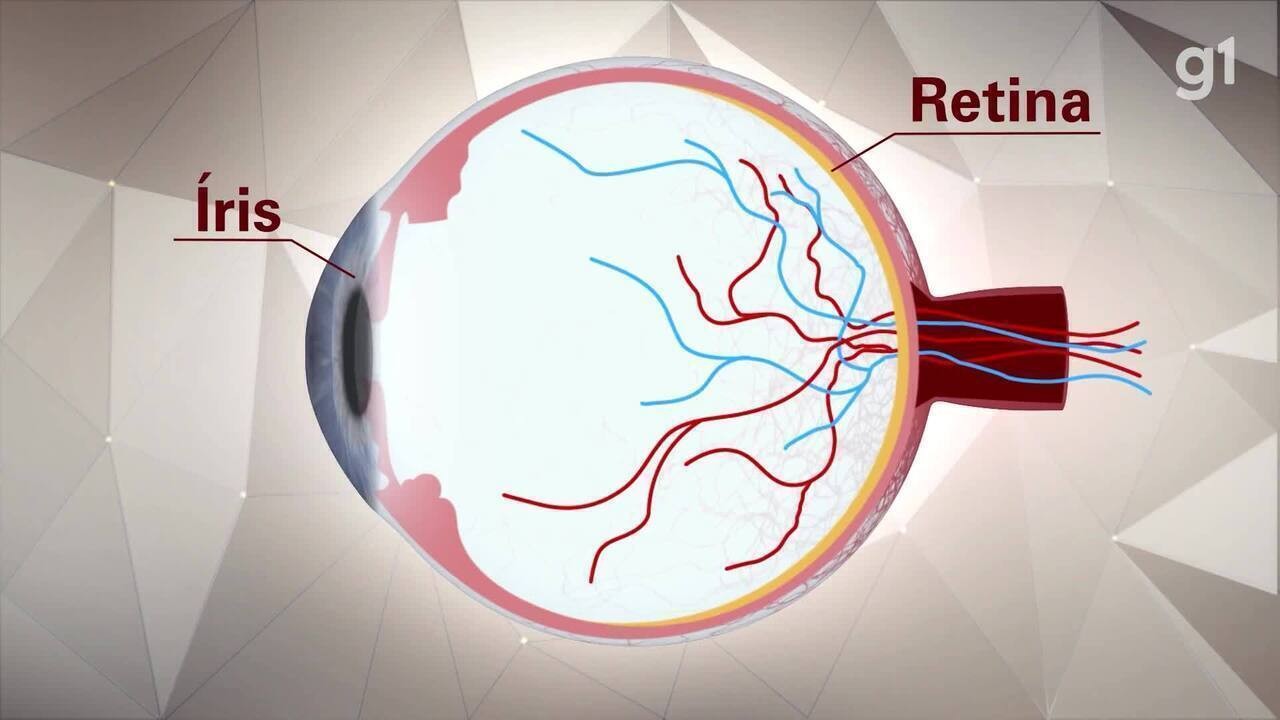 Neuroblastoma Entenda O Que E Quais Os Sintomas Do C Ncer Do Filho