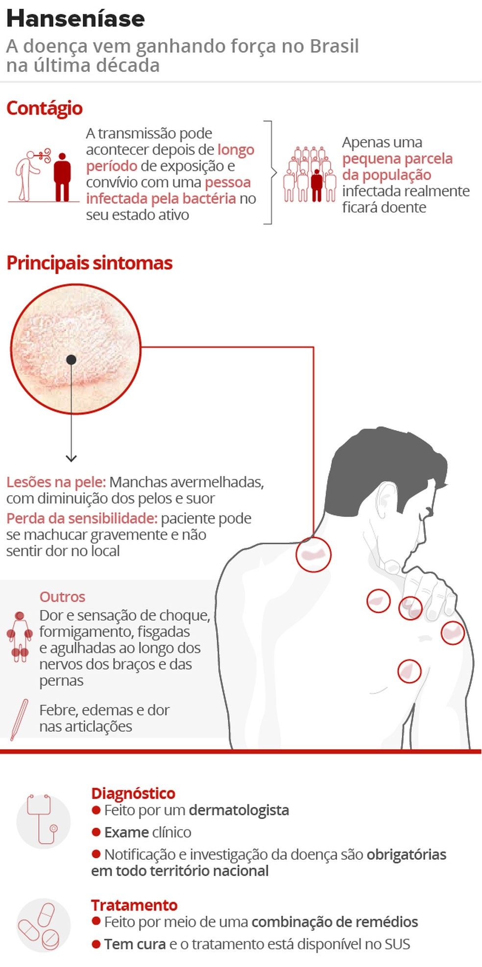 O que � a hansen�ase e os n�meros altos de cont�gio no Brasil. � Foto: Arte/g1