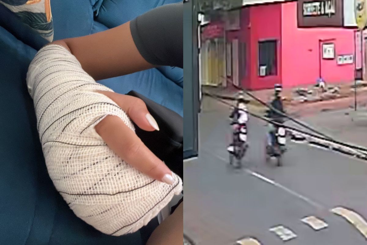 Fisioterapeuta é perseguida e atacada com barra de ferro no caminho para o trabalho em Campo Grande