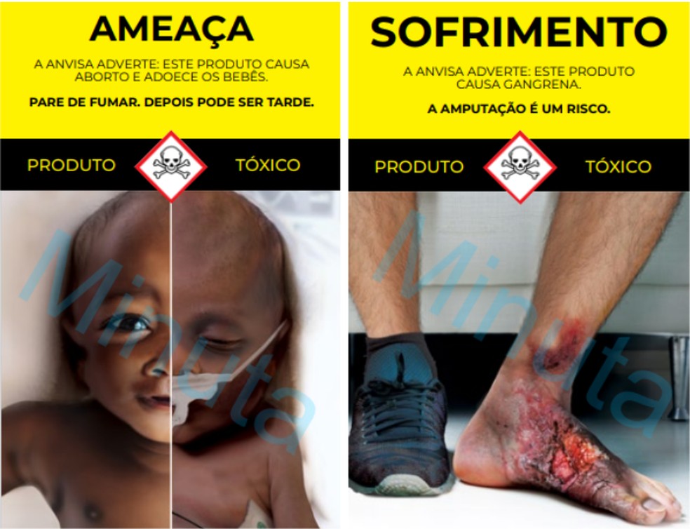Novas imagens e mensagens propostas pela Anvisa ressaltam os efeitos nocivos do tabaco. — Foto: Reprodução/Anvisa