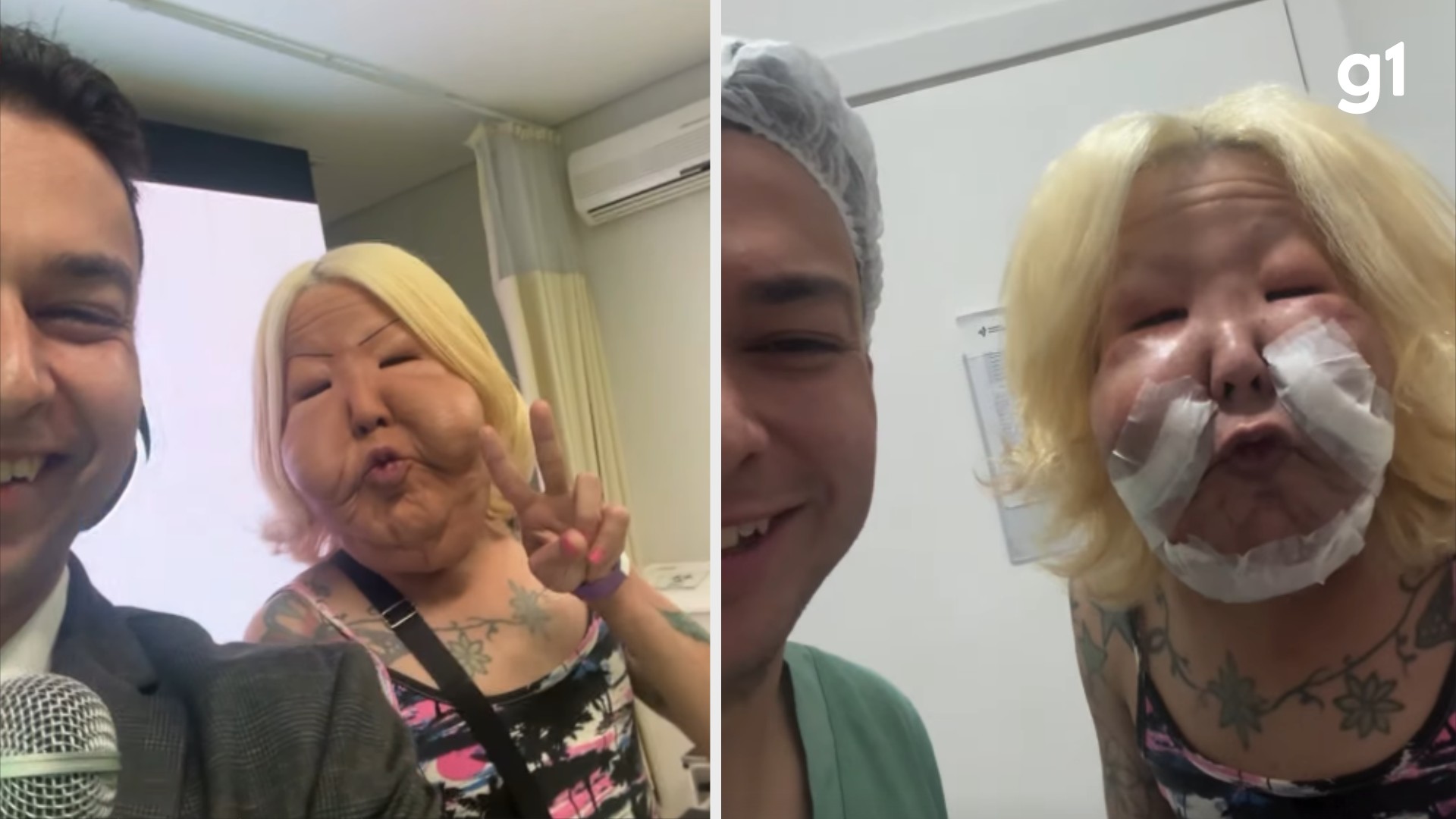 Quem é 'Juju do Pix', influenciadora do RS que passou por cirurgia reparadora para retirar óleo mineral do rosto