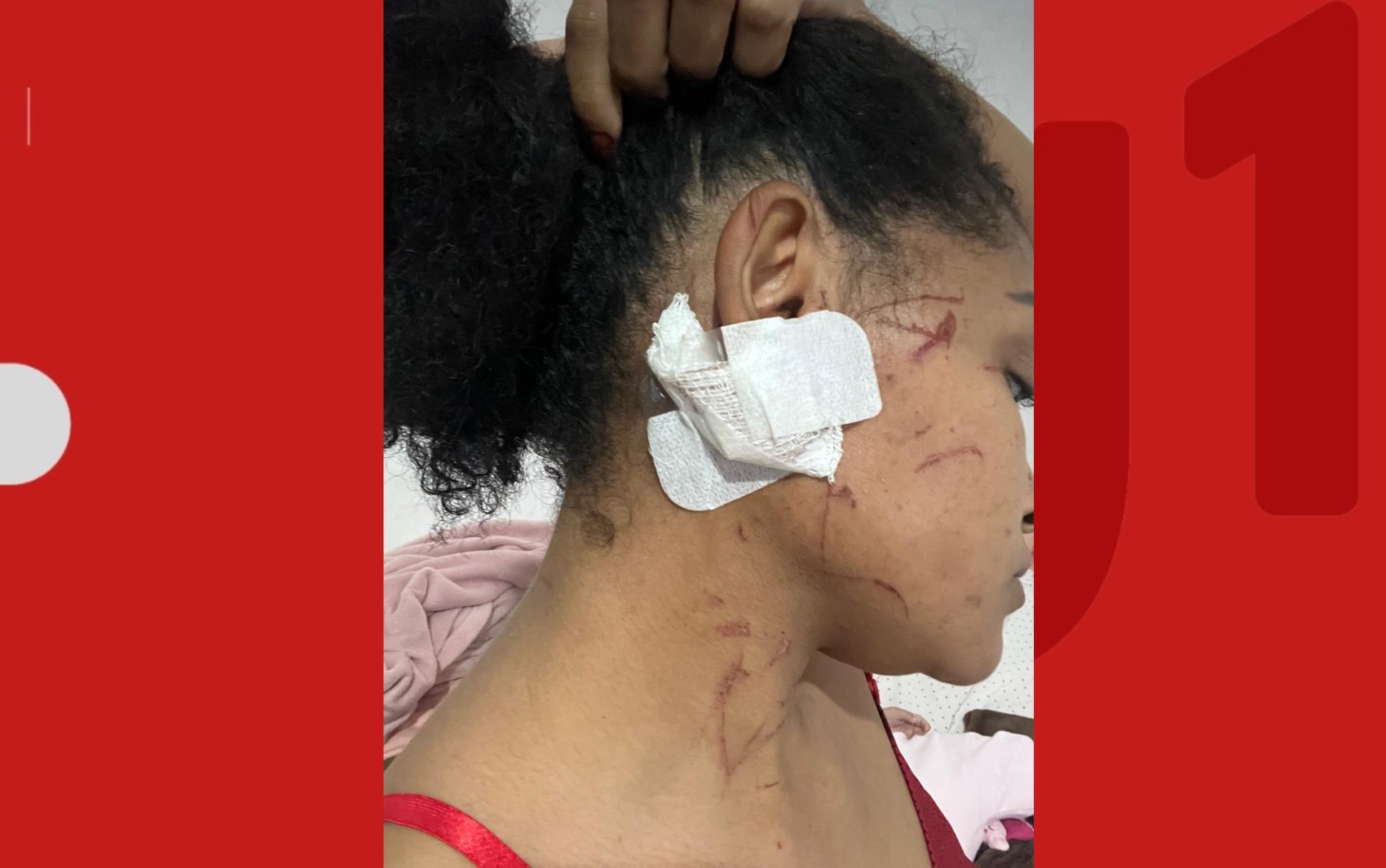 Panorama: Mulher relata ter sido arrastada por carro de ex-companheiro após briga em Feira de Santana