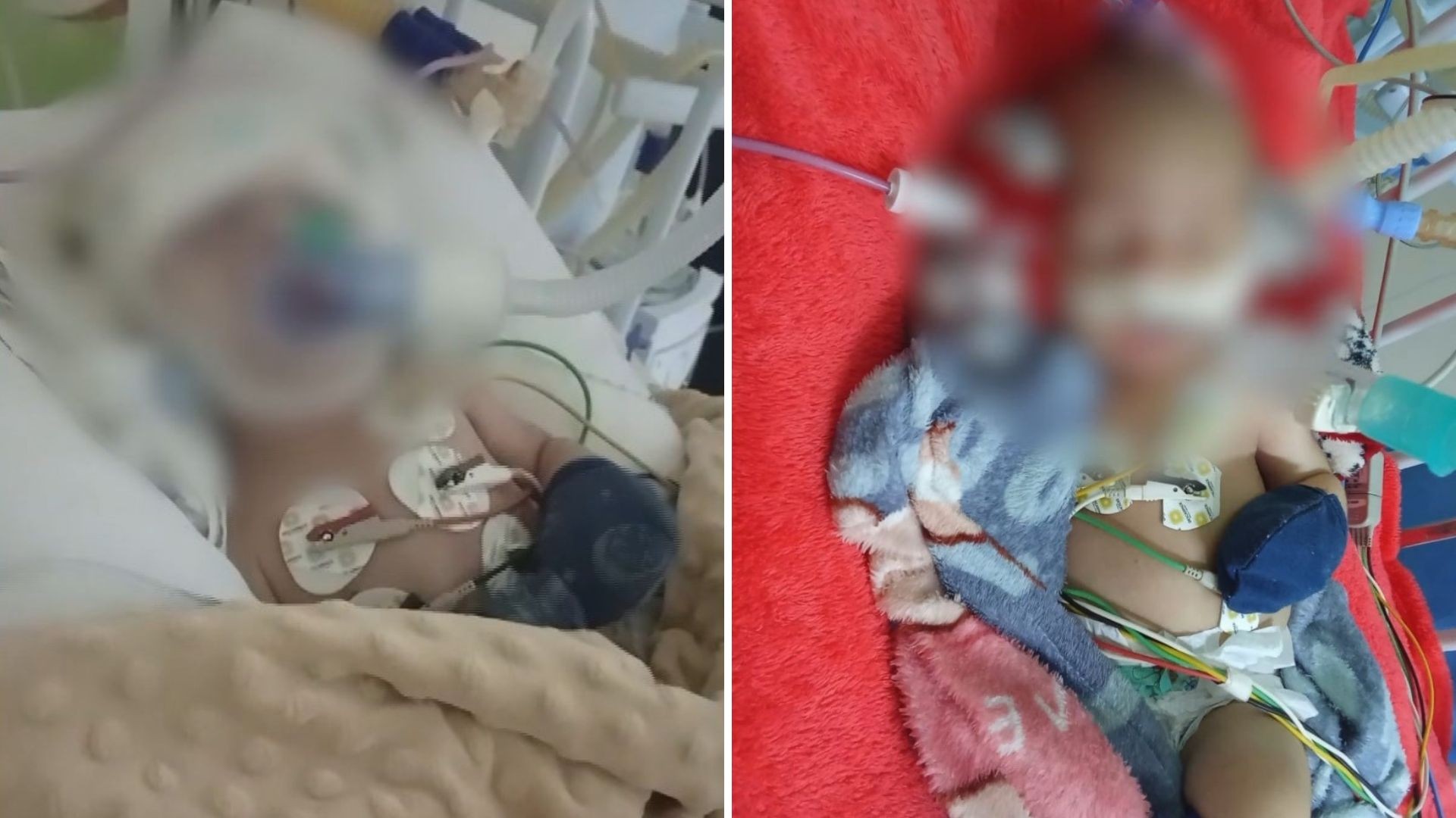 Bebê que levou soco e sofreu traumatismo craniano continua na UTI um mês após agressão no ES