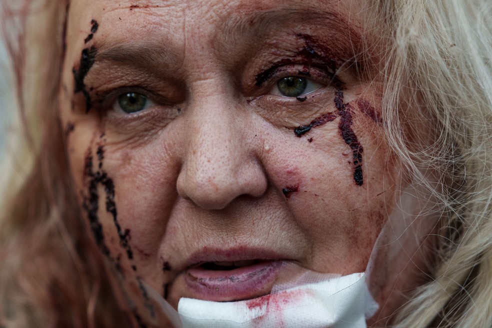 Olena Dniprovska, ferida, senta-se no quintal de sua casa danificada após um ataque russo em Kiev — Foto: AP/Evgeniy Maloletka