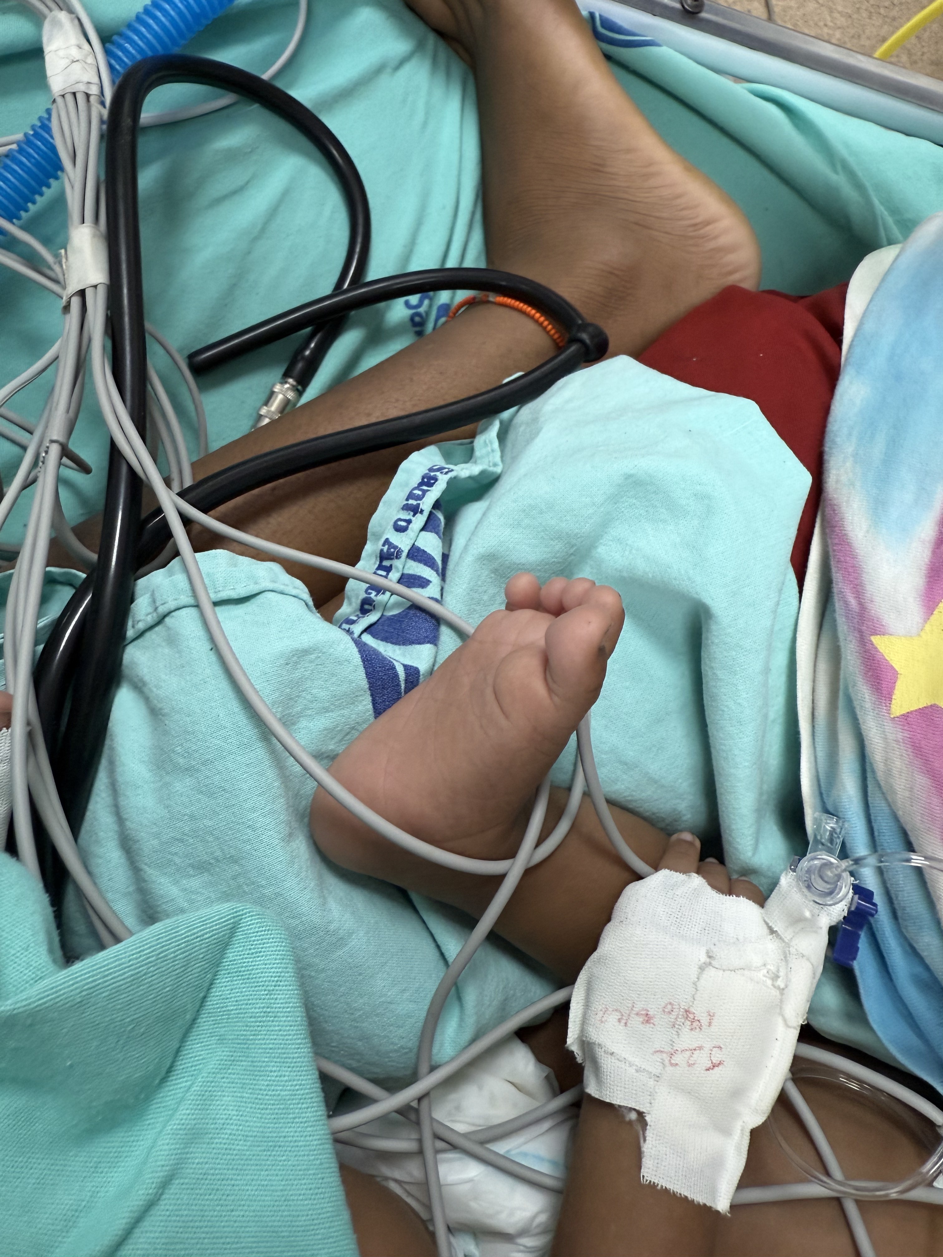 Sobe número de crianças indígenas Yanomami com coqueluche em Boa Vista  