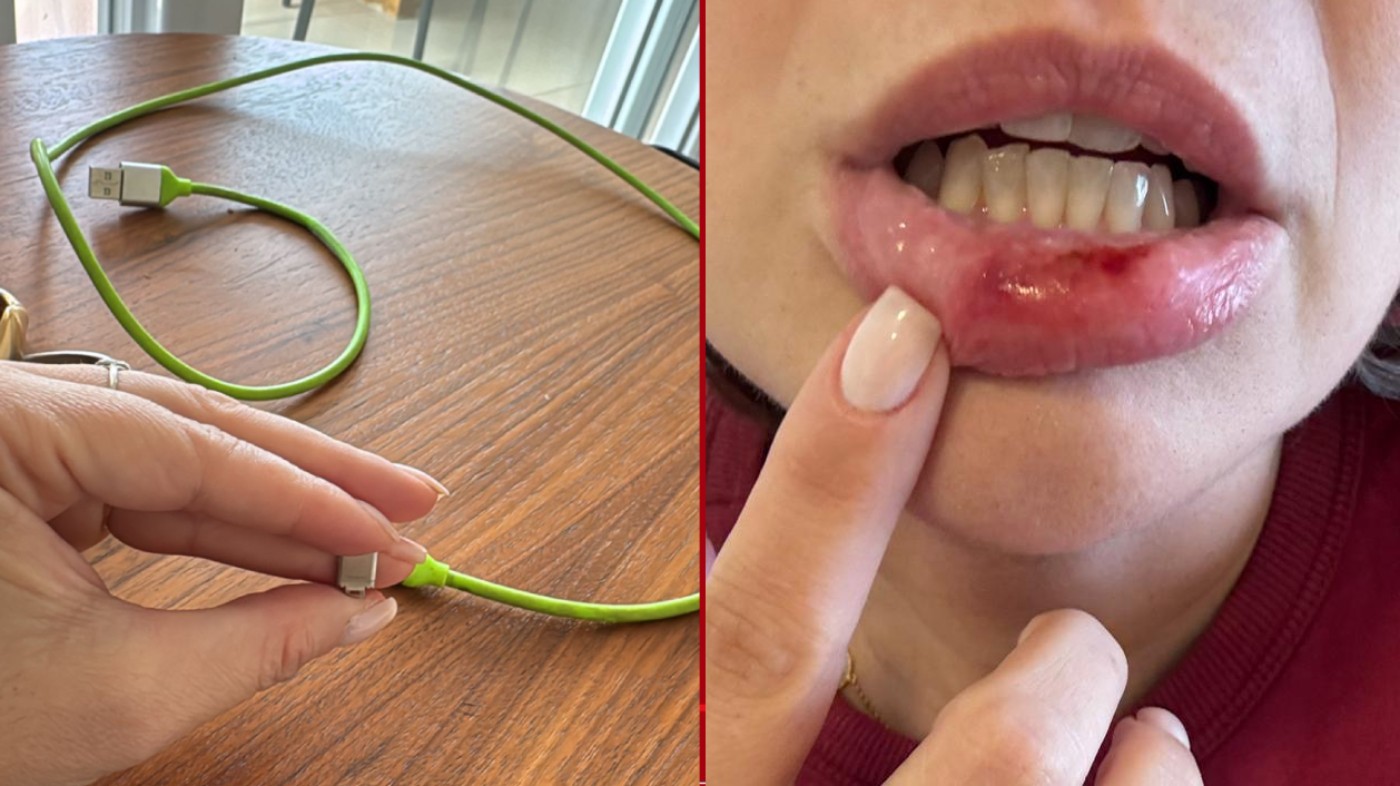 Empresária do Paraná tem convulsão e perde a memória temporariamente depois levar choque em cabo de carregador: 'Quase morri'