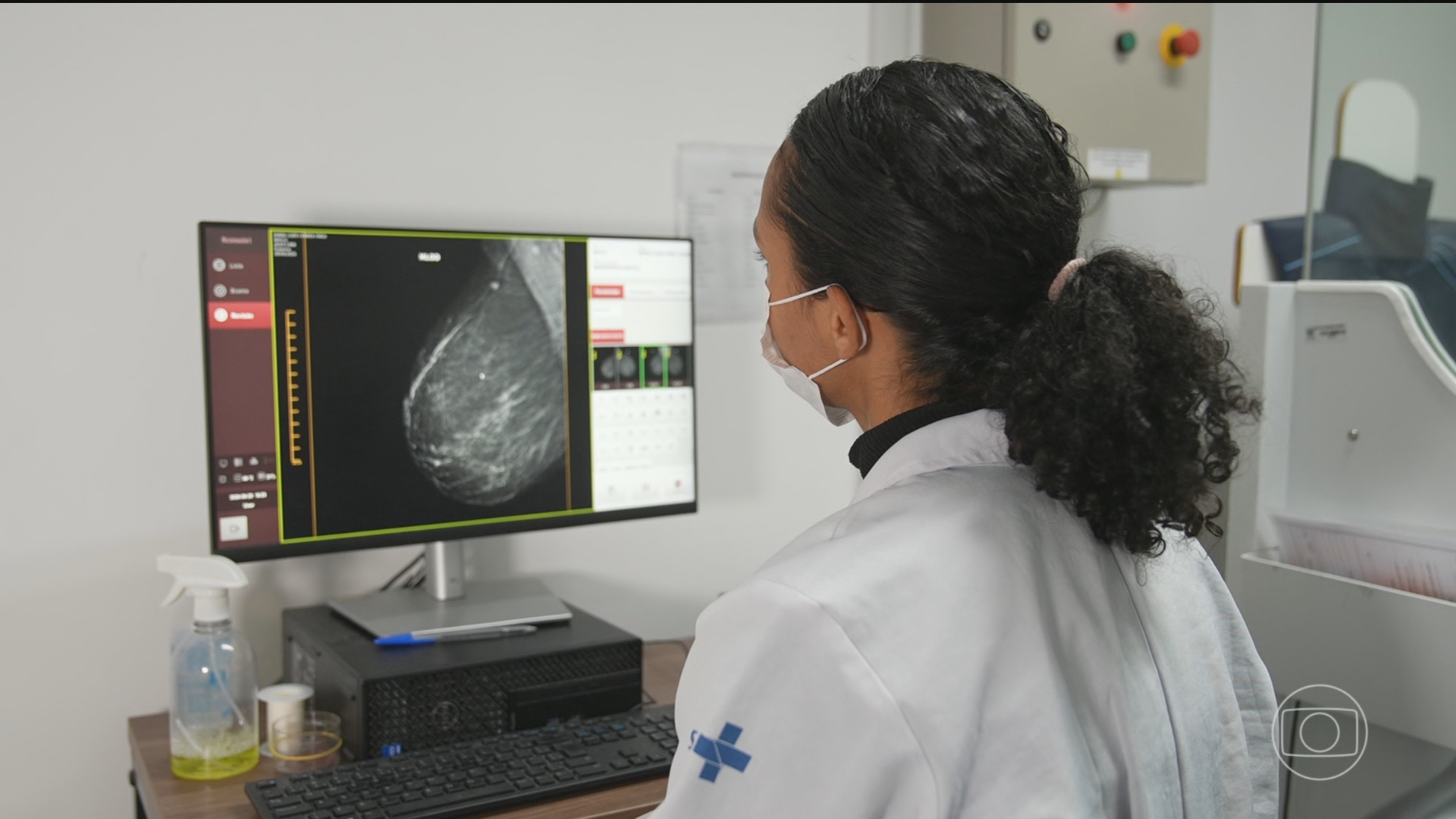 Planos de saúde são obrigados a fazer mamografias em mulheres com menos de 40 anos que tenham indicação médica