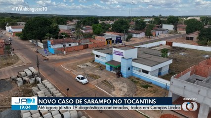 Novo caso de sarampo é confirmado no Tocantins; saiba mais