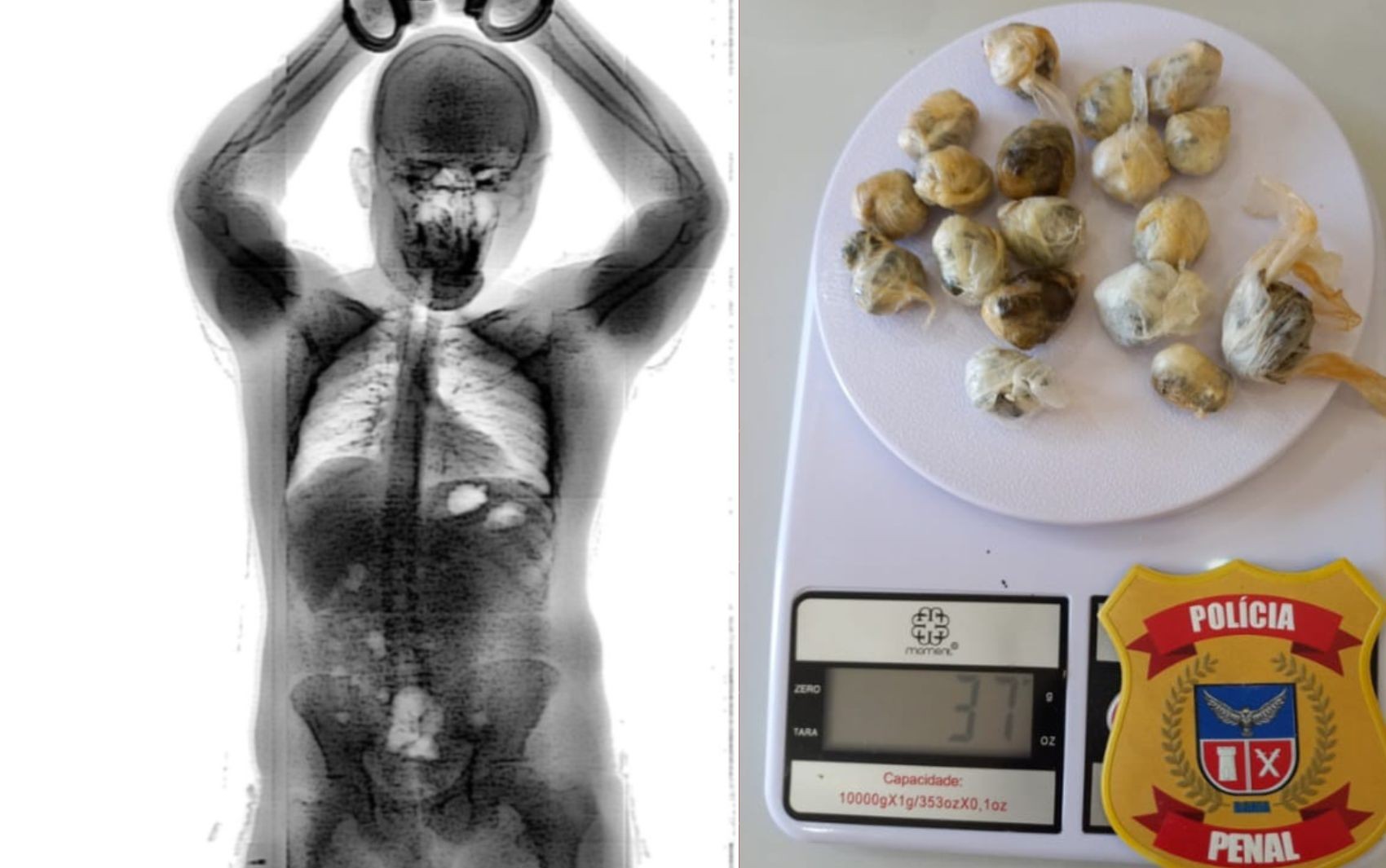 Homem engole 18 porções de maconha para entrar em presídio na Bahia; raio-x mostra pacotes no intestino
