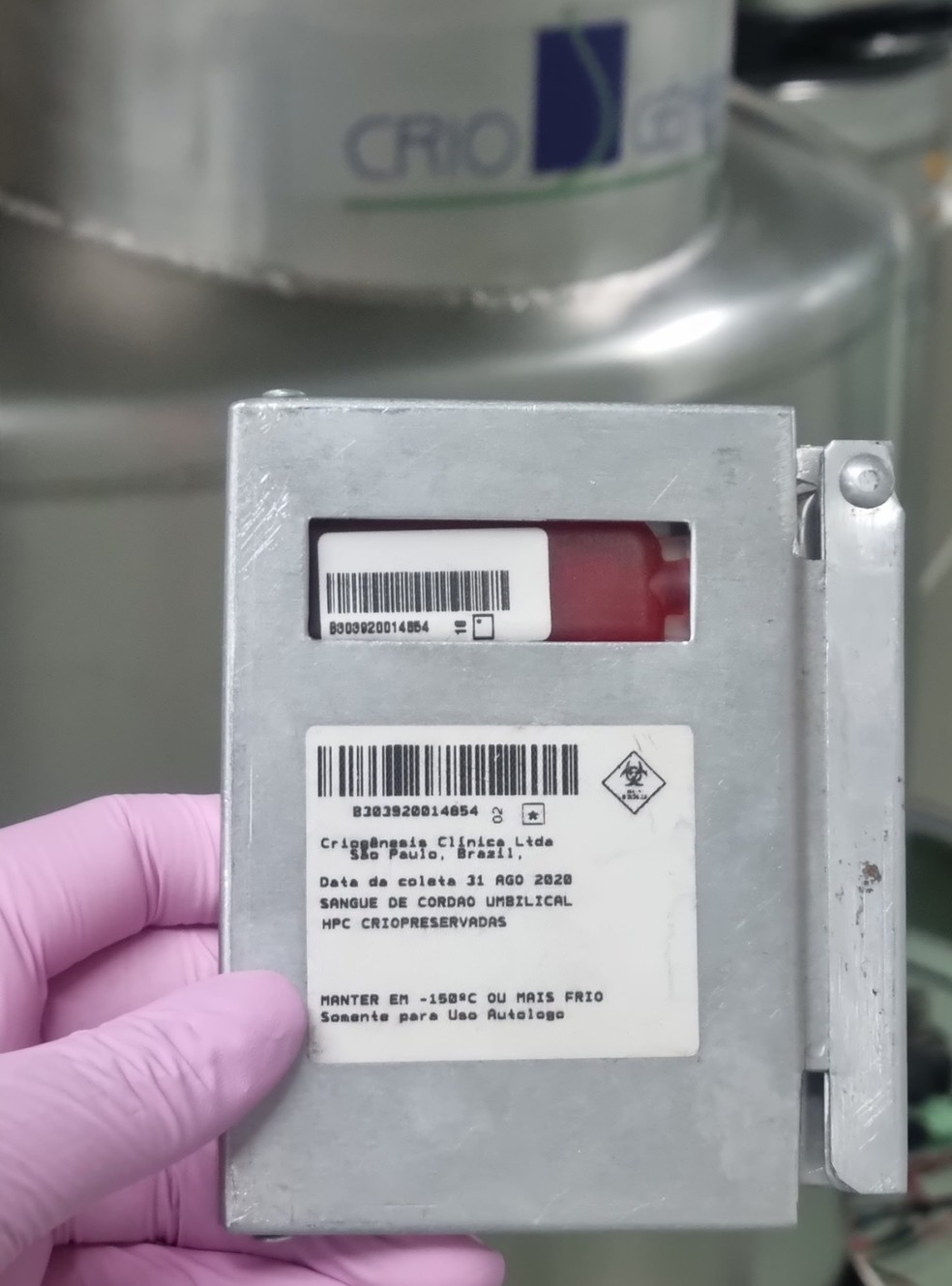 Coleta de sangue de cordão umbilical é rápida, indolor e custa em torno de R$ 4 mil — Foto: Cortesia/Criogênesis