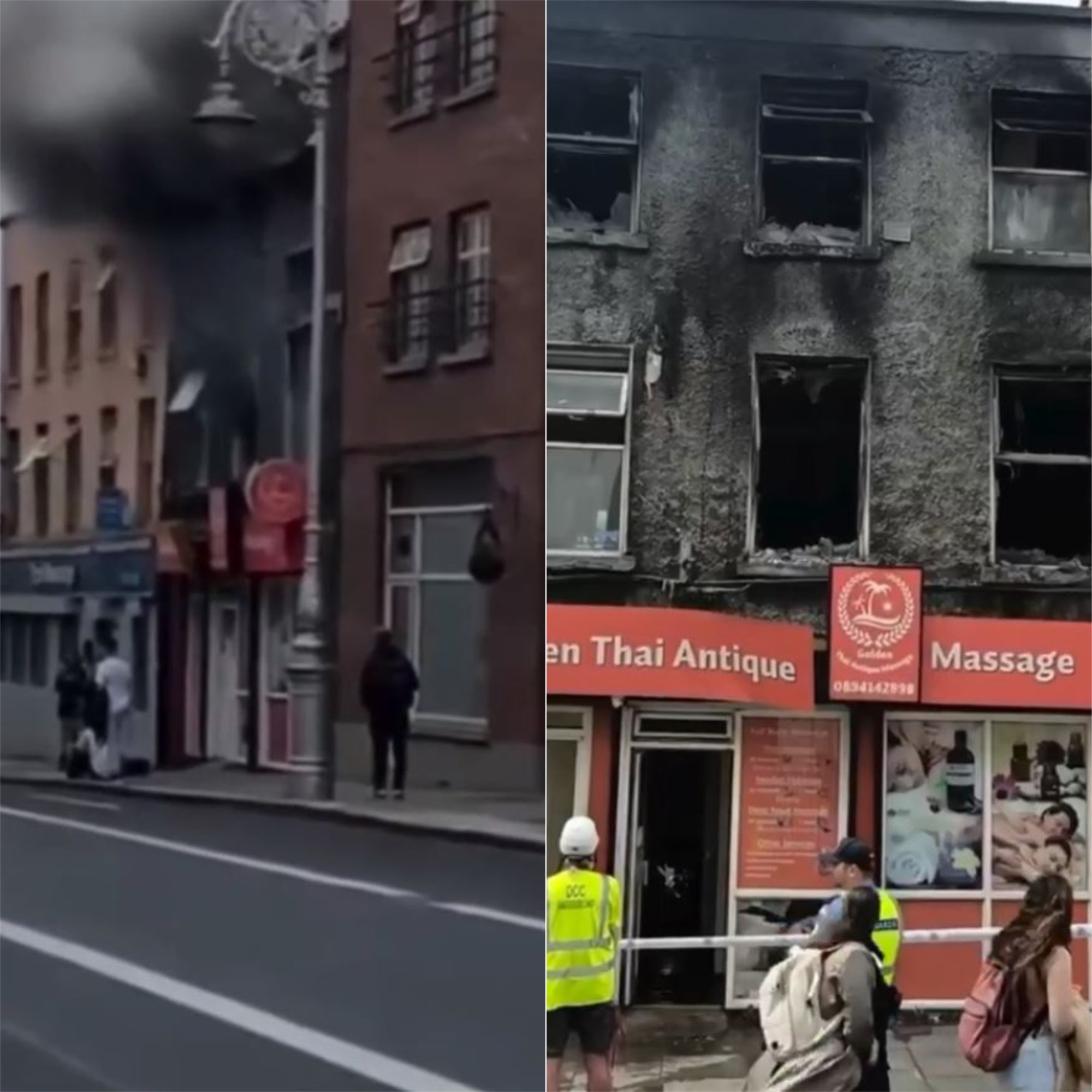 Potiguar fica em estado grave após incêndio em prédio na Irlanda