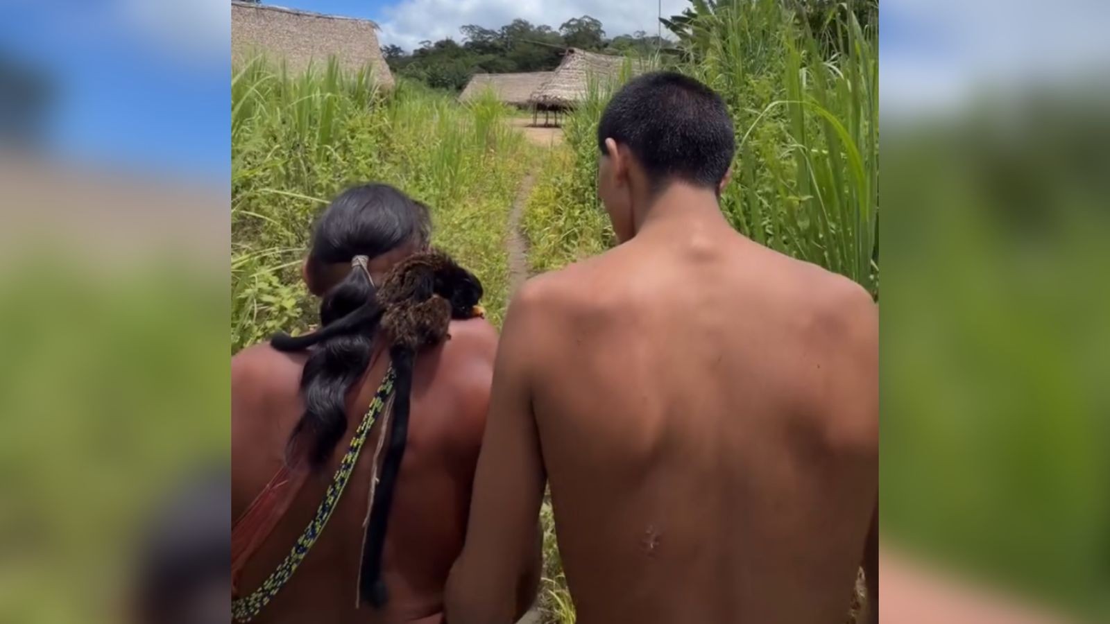 Indígena Zo’é ferido por flecha recebe alta e retorna para aldeia após cirurgia em Santarém