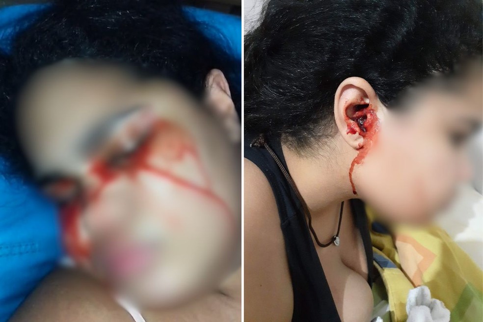 Famlia alega que jovem passou a sangrar pelos olhos desde o incio do ms  Foto: Arquivo Pessoal