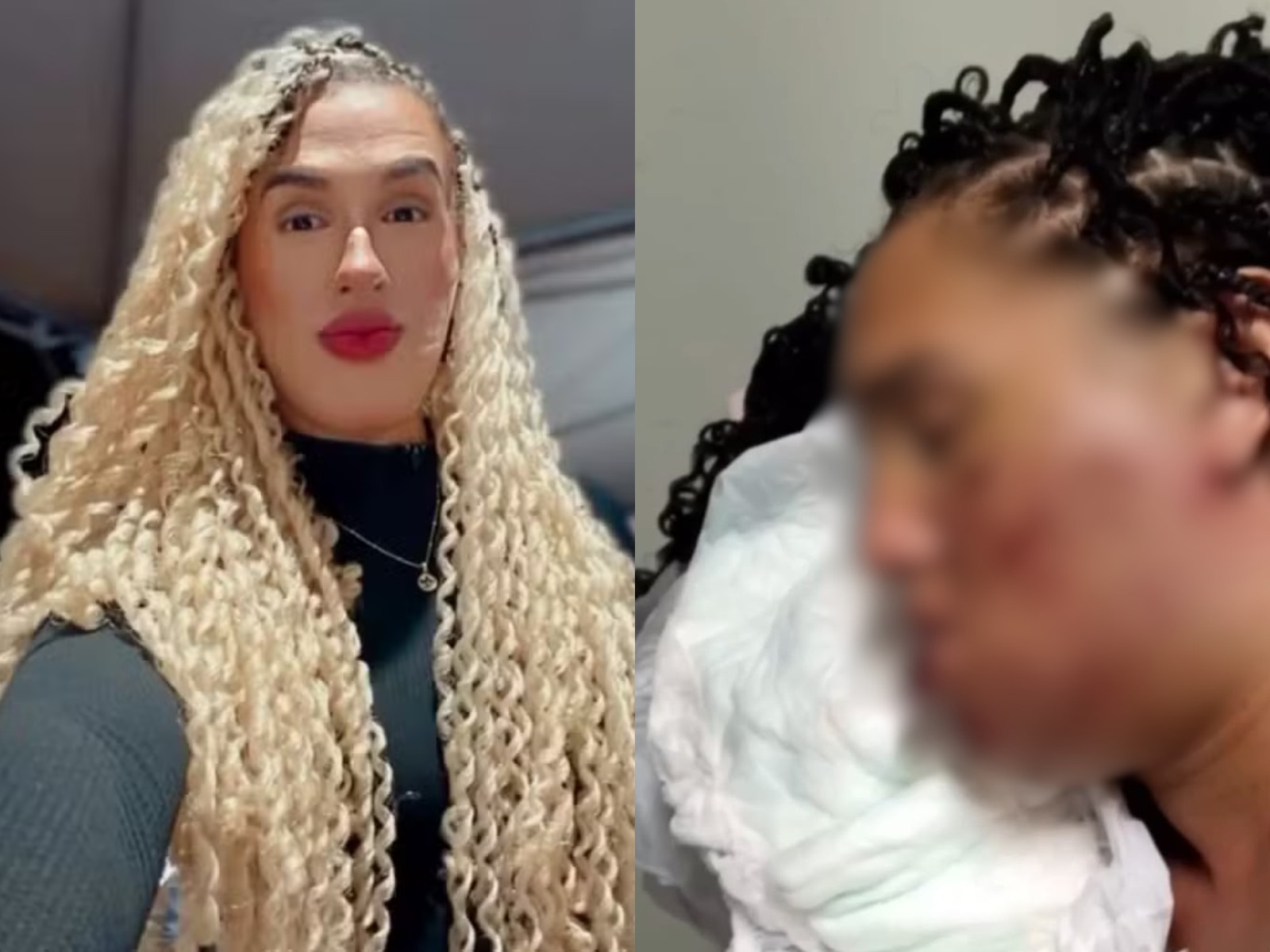 Mulher trans revela à família que foi espancada por cliente em parque no Acre