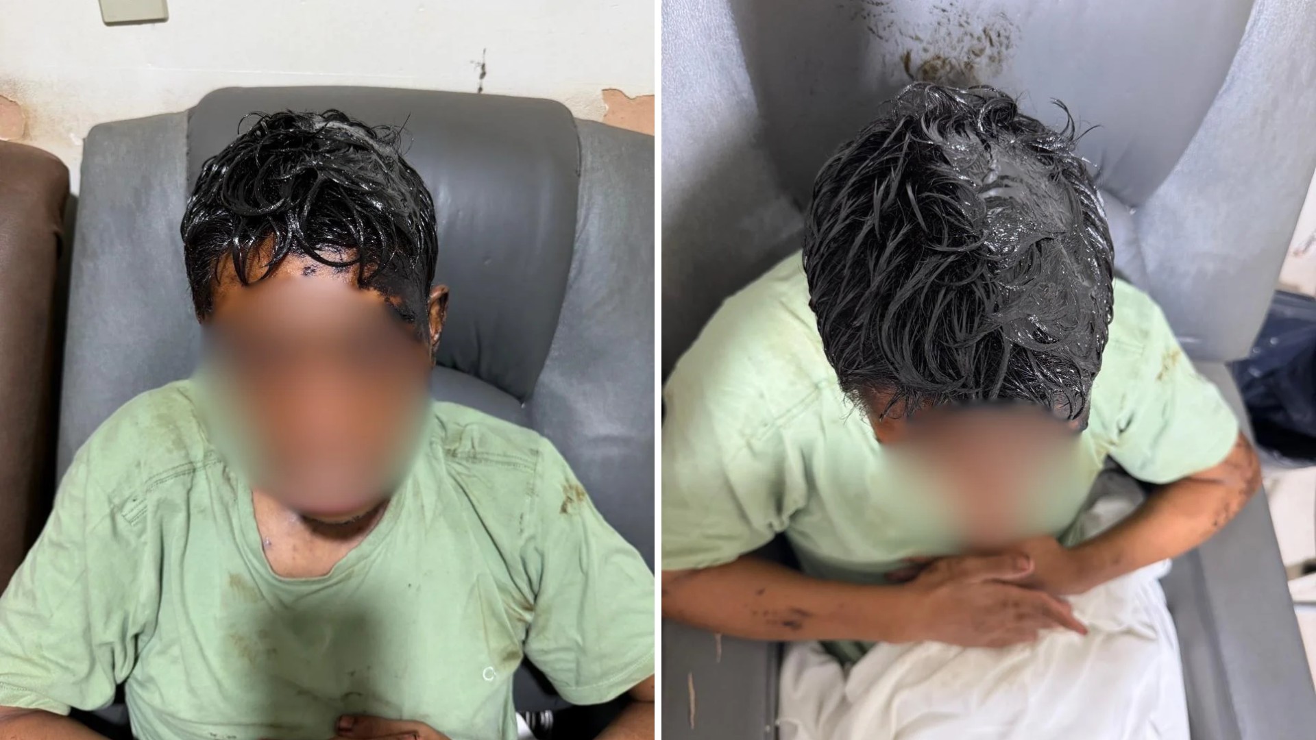 Idoso com deficiência intelectual é alvo de ataque com óleo diesel queimado em ação condenada pela avó