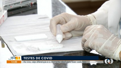 Testes de Covid-19: veja diferenças e o momento ideal para fazer cada tipo