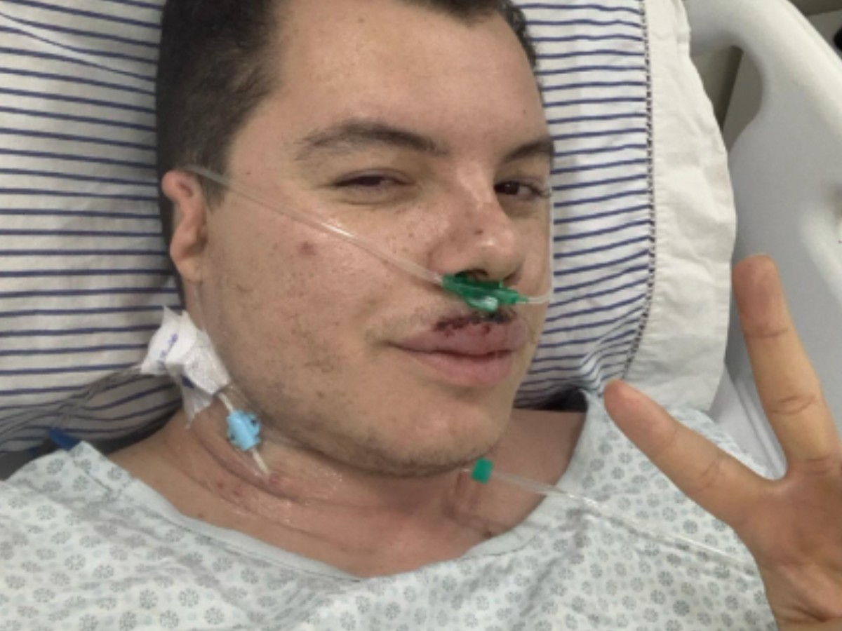 Influenciador agredido por estudantes em festa universitária deixa UTI no interior de SP