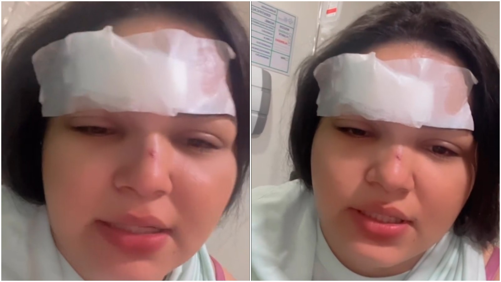 Cantora tem testa cortada por golpe de gargalo de garrafa em briga motivada por ciúme