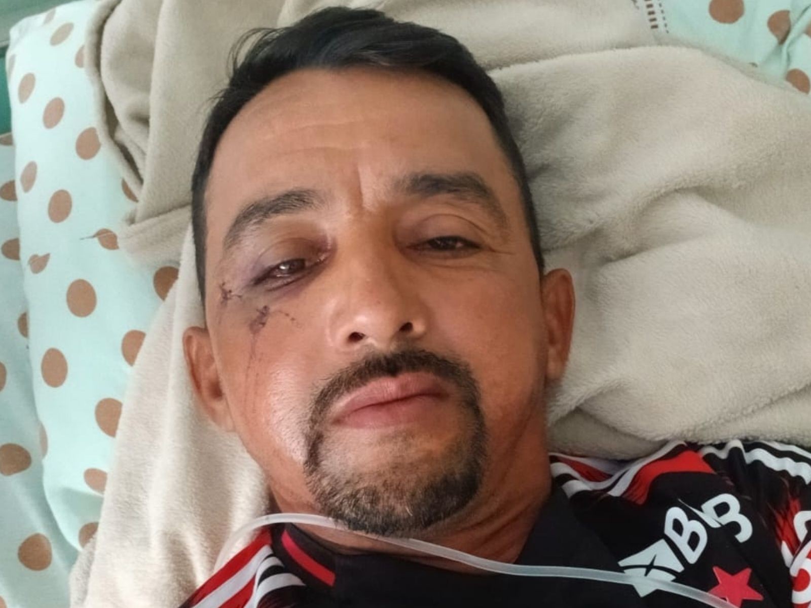 Gari agredido com tijolada no AC vai passar por cirurgia para colocar pinos no rosto: 'Nunca bati em ninguém'