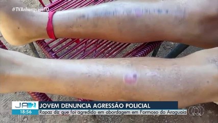 Jovem acusa policiais de agressão em abordagem e dentro de hospital no sul do TO