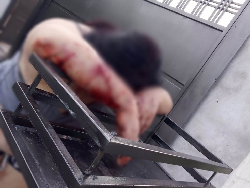 Mulher foi atacada por dois cães da raça pit bull, em Estrela d'Oeste (SP) — Foto: Arquivo pessoal