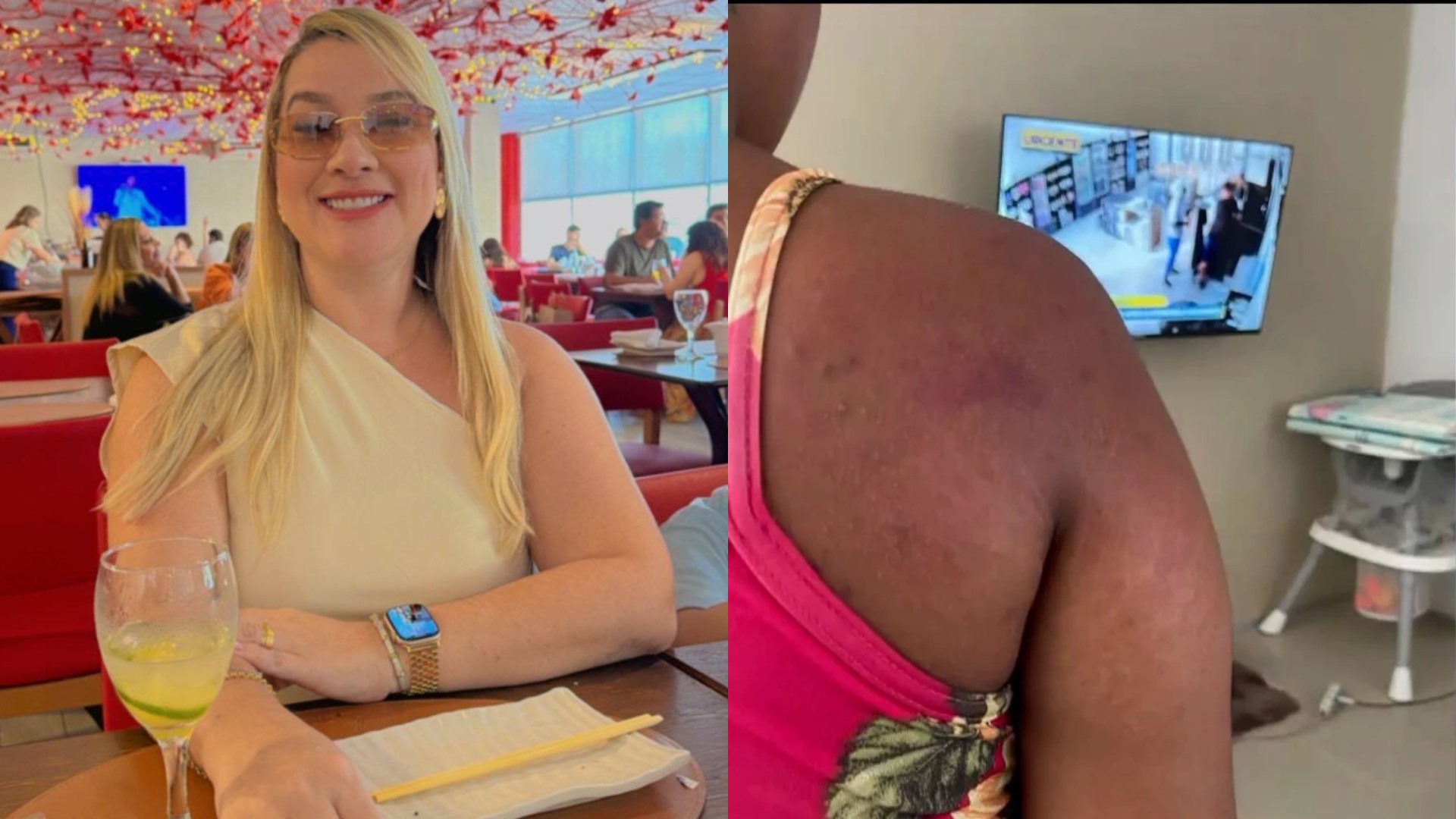 OAB pede prisão de patroa que agrediu doméstica grávida no MA; entidade classificou crime como tortura