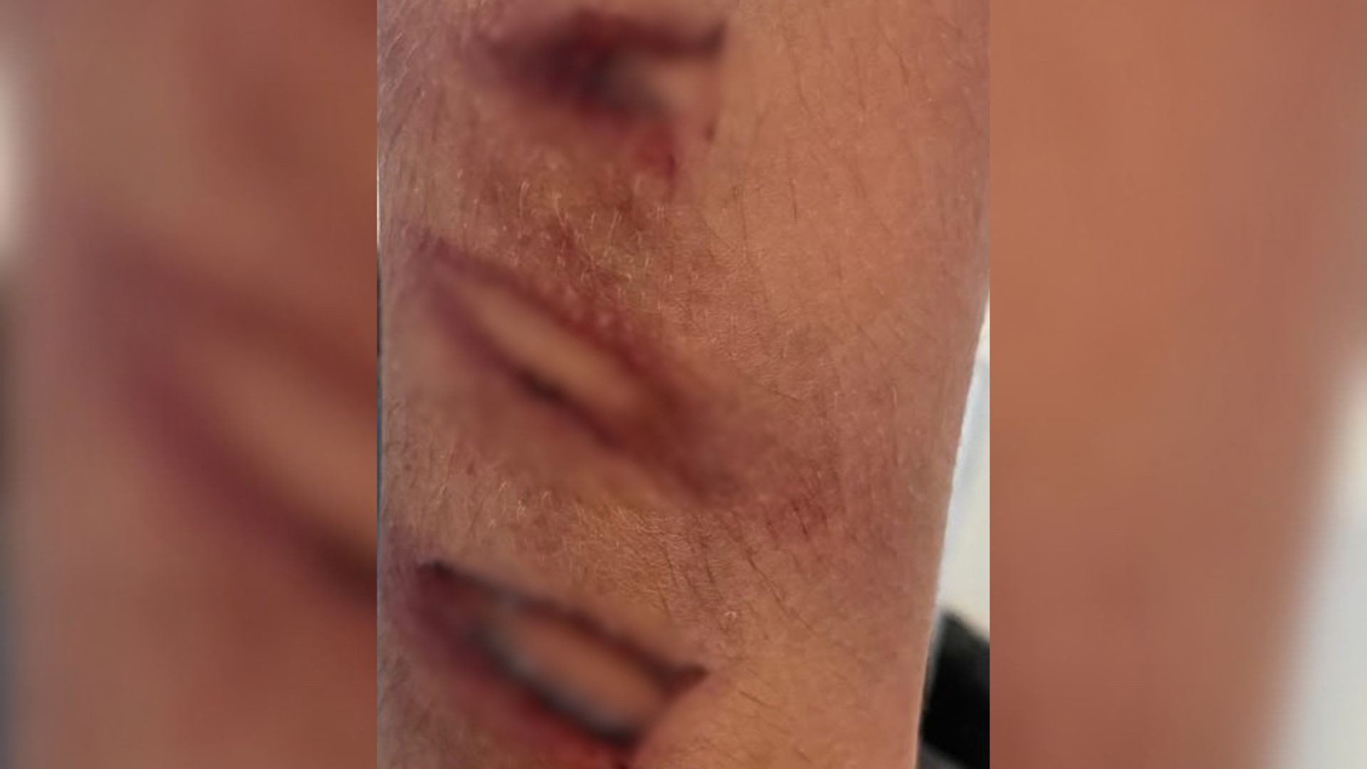 Homem é preso por maus-tratos após espancar enteado com pedaço de mangueira no noroeste de SP