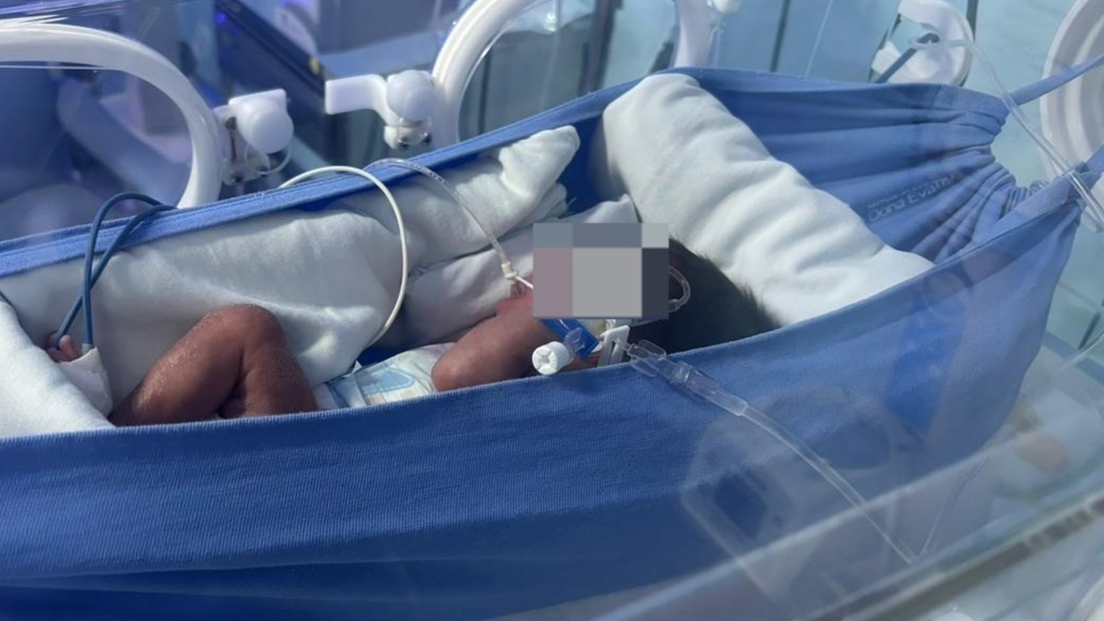 Redinhas ajudam no desenvolvimento e conforto de bebês prematuros em maternidade no PI; veja vídeo