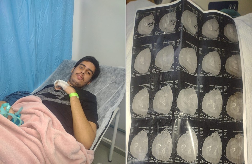 Jovem diagnostica com autismo de nivél três de suporte no Hospital em Araruama — Foto: Arquivo Pessoal