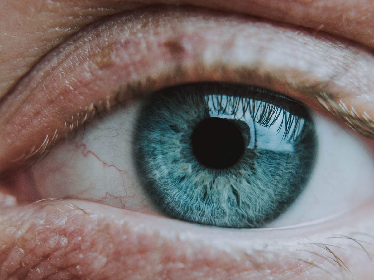 Pálpebras inchadas? Veja quais são os sintomas e tratamentos do terçol ...