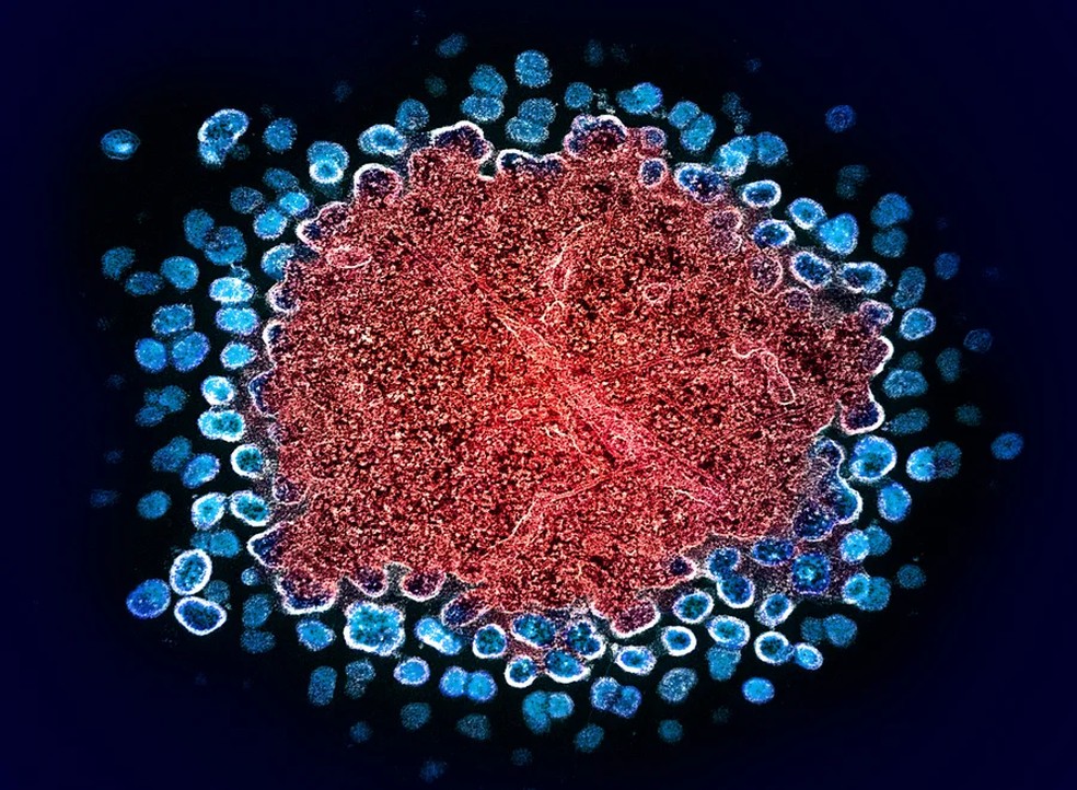 Registro de uma transmissão colorizada de numerosas partículas do vírus HIV replicando-se a partir de uma célula T. — Foto: NIAID