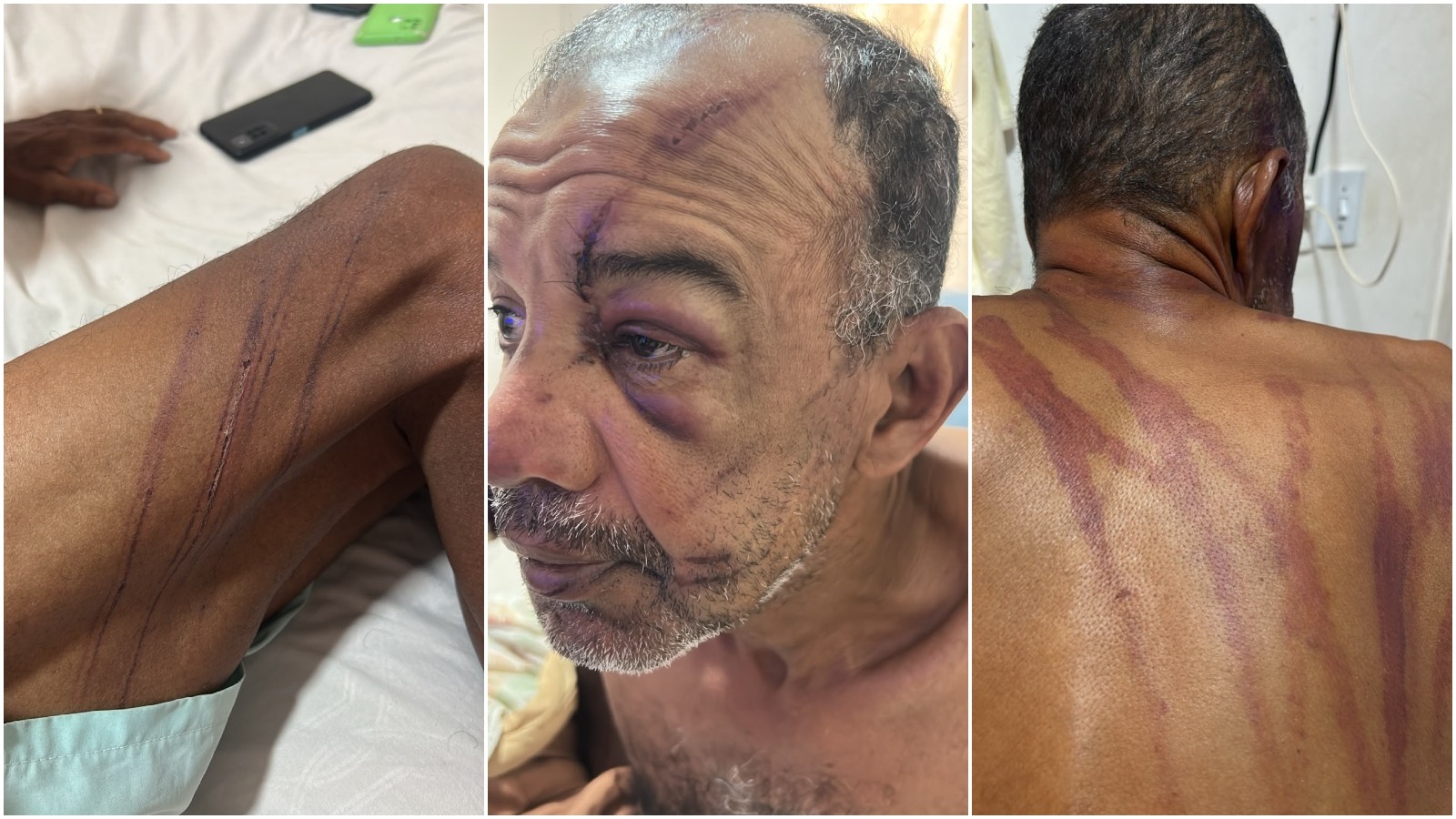 Homem denuncia ter sido espancado por seguranças de barraca na Praia do Futuro, em Fortaleza