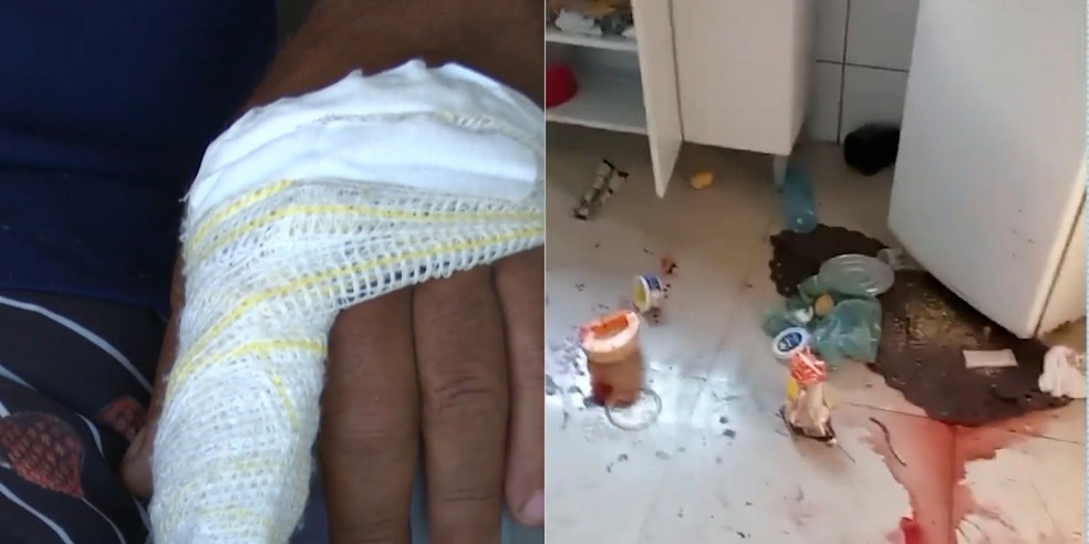 Professor quase perde o dedo após ser mordido por macaco no interior do MA — Foto: Reprodução/TV Mirante