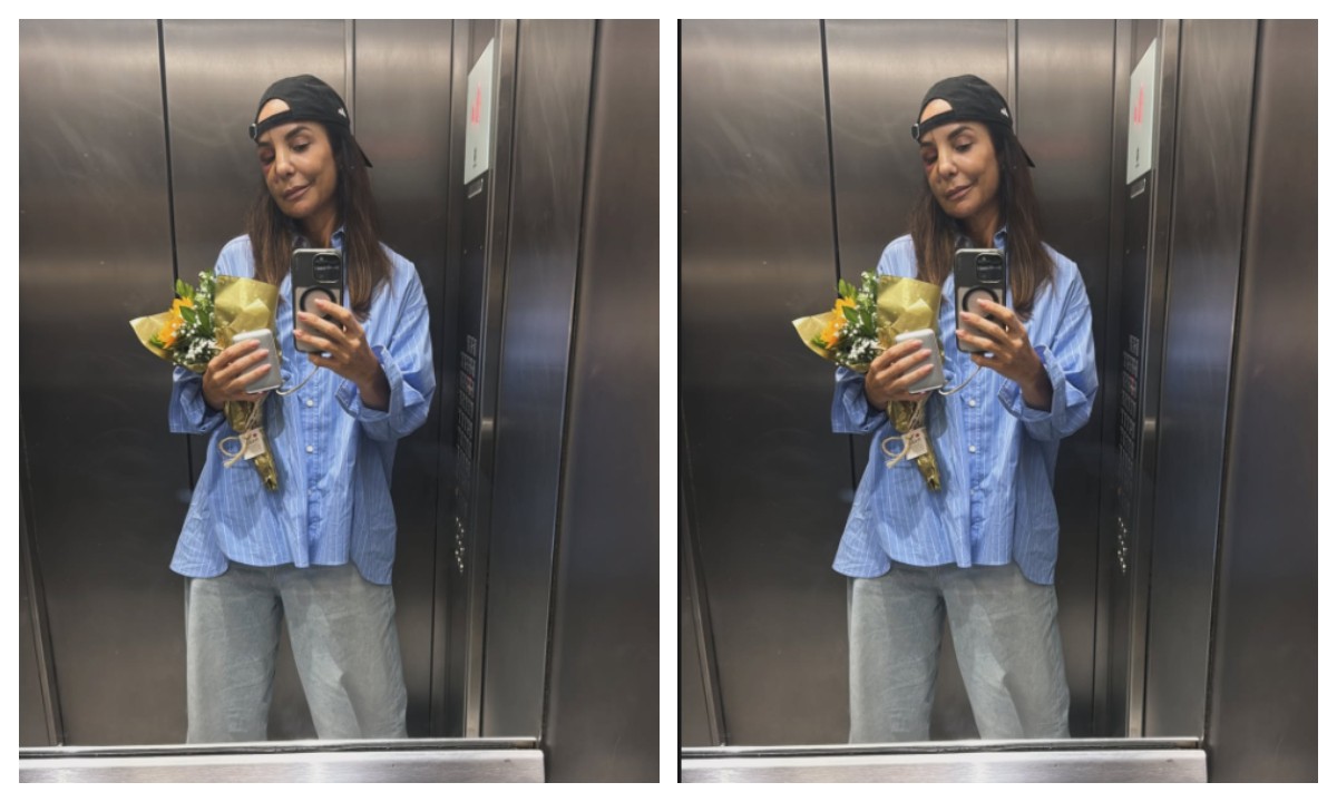 Ivete Sangalo tem alta de hospital em SP após cirurgia no rosto