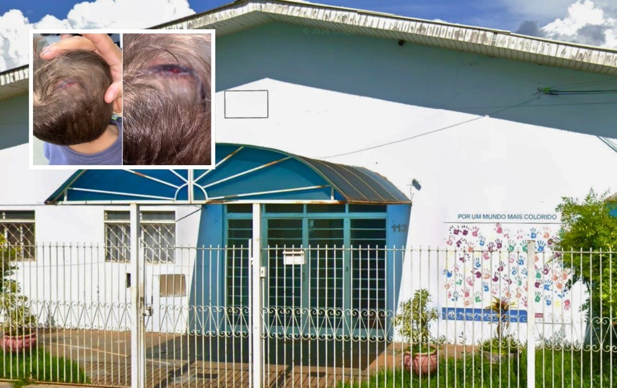 Bebê sofre corte na cabeça em creche e pais cobram explicações no interior de SP: 'Foi grave'