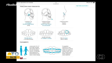 Especialista explica sobre saúde bucal no Bom Dia Responde