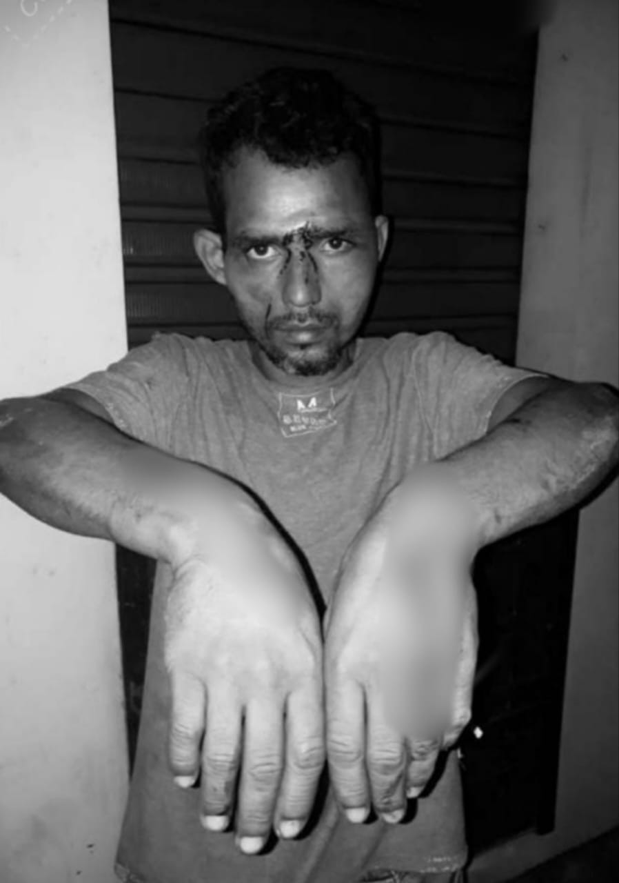 Homem que foi espancado e pregado em assoalho de casa por PMs no AC pede indenização de R$ 300 mil