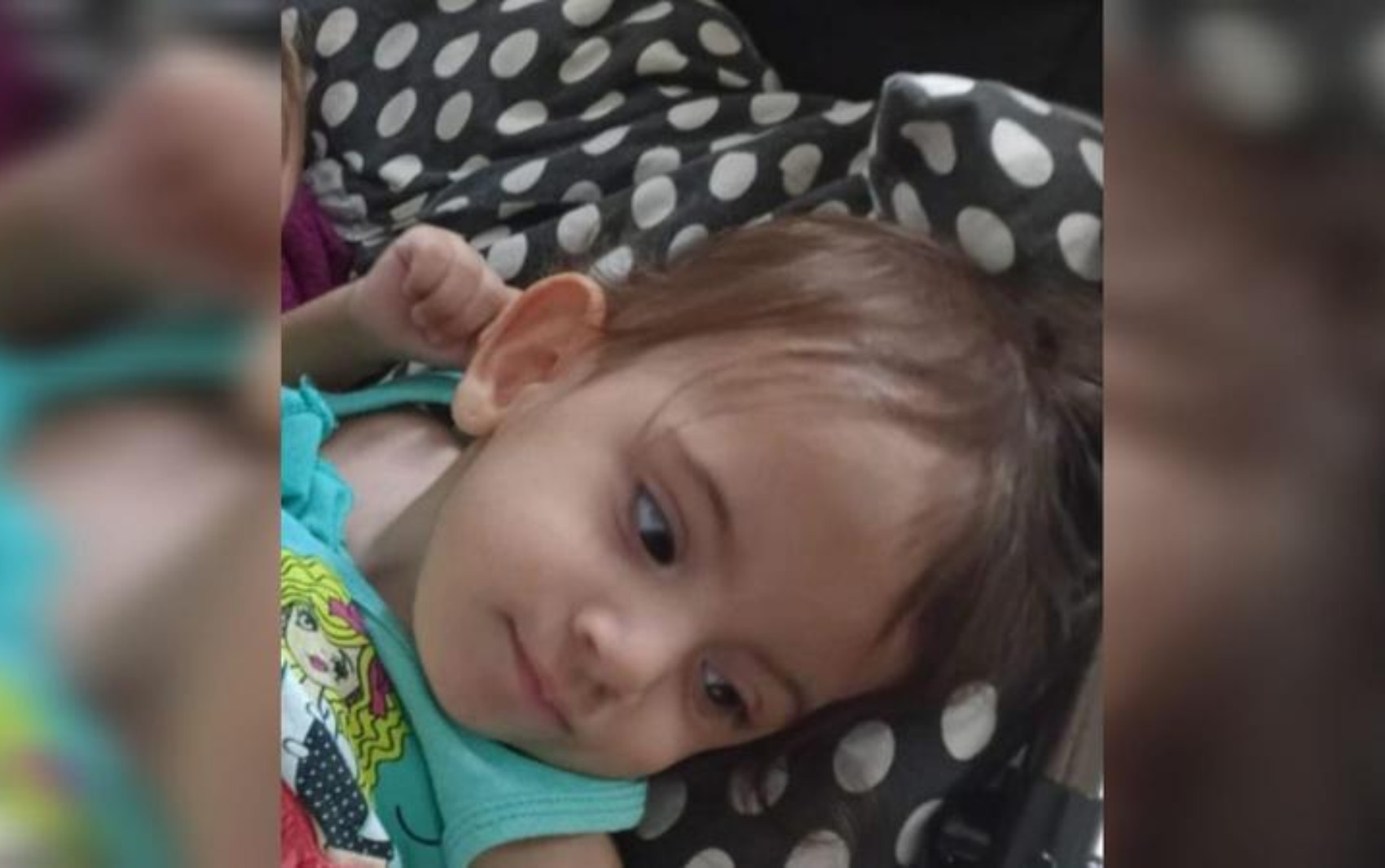 Febre de gêmea de SP que passou por cirurgia de separação em Goiânia diminui e indicativos ‘são positivos’, avalia Calil
