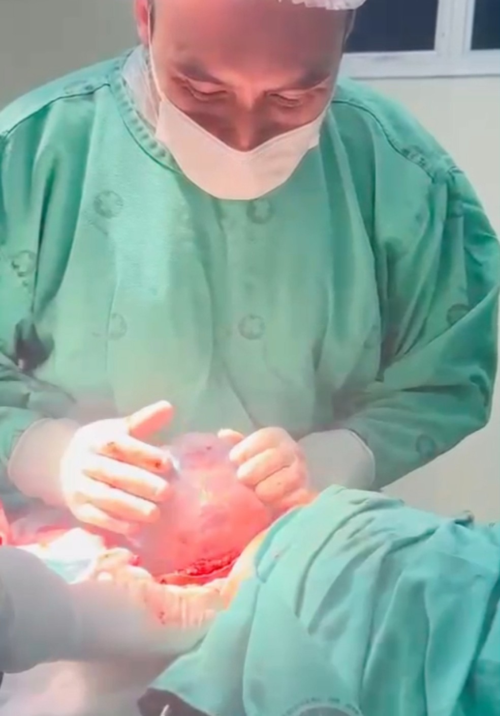 Médico acreano faz parto com bebê empelicado — Foto: Arquivo pessoal