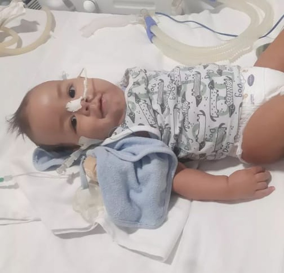Bebê Henry foi diagnosticado com AME tipo 1 e aguarda medicamento pelo SUS — Foto: Reprodução