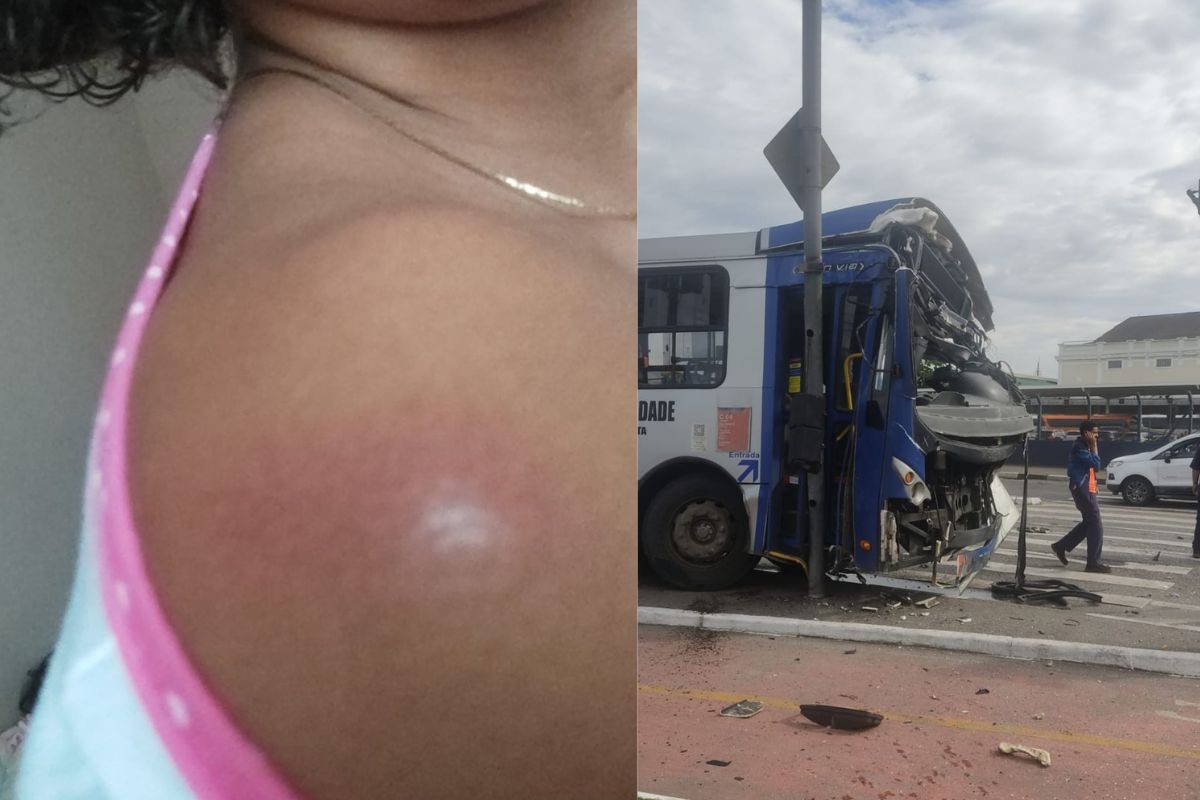 'Pensei que fosse morrer', diz passageira de ônibus destruído por caminhão no litoral de SP; VÍDEO