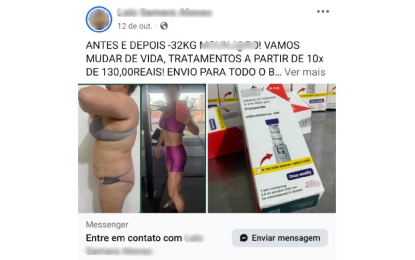 Cabeleireira é presa por suspeita de vender canetas emagrecedoras em salão em Jaboticabal, SP