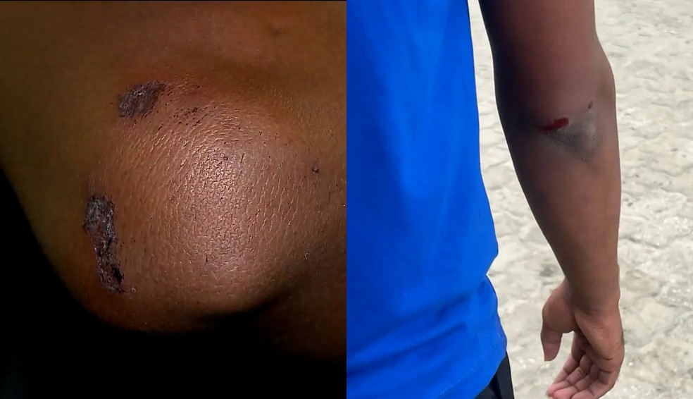 Caso será investigado pela Polícia Civil do Maranhão — Foto: Reprodução/TV Mirante