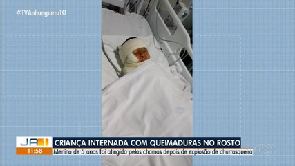 Explosão em churrasqueira deixa homem morto e criança com queimaduras